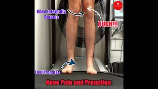 knee pain and overpronation [upl. by Star211]