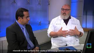 Pathology Insights Pleural Fluid  CytoHisto Correlation [upl. by Rocray]