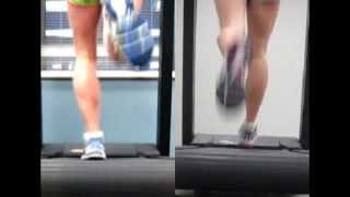 Shin Splint  Video Analysis RunSmart Online [upl. by Anirbes198]