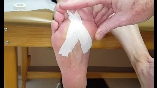 Plantarflexion Taping for Plantar Plate Tears [upl. by Anitnerolf]