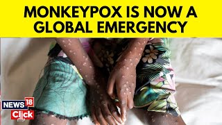 Mpox Declared Public Health Emergency Of International Concern Now What  Monkey Pox Cases  N18G [upl. by Candie]