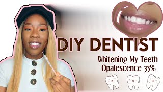 DIY DENTIST  Teeth Whitening using Opalescence 35 Gel [upl. by Harbot]