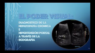 EL PODER VISUAL DIAGNOSTICO ECOGRAFICO DE LA HEPATOPATIA CRONICA E HIPERTENSION VENOSA PORTAL [upl. by Inaboy]