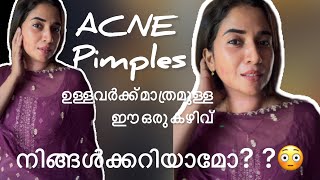 🤩AcnePimples ഉള്ളവർക്ക് മാത്രമുള്ള ആ കഴിവ് കേൾക്കണോ🤩pimple youtube trending viralvideo [upl. by Sinai387]