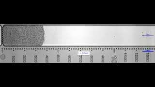 Growth of a yeast clog in a microfluidic chip [upl. by Annai]