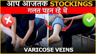 How To Wear Stockings For Varicose Veins  Dr Gaurav Gangwani Interventional Radiologist [upl. by Garratt]