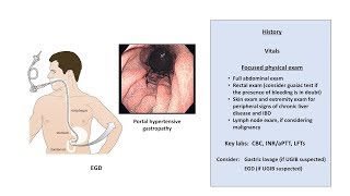 An Approach to GI Bleeding Melena Hematemesis Hematochezia [upl. by Farlie499]