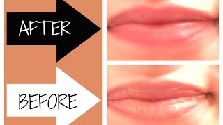 How To Fix Chapped Lips Fast [upl. by Dewhurst245]