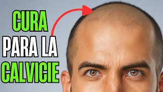 Combatiendo la ALOPECIA de Forma Natural ESTRATEGIAS Holísticas para la SALUD CAPILAR [upl. by Underwood]