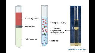 Ring Precipitation Test Principle Procedure Result [upl. by Rubliw]