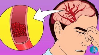 सिर दर्द के आसान उपाय  Head pain treatment [upl. by Noyr]