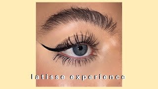 HOW I GOT HUGE EYELASHES AND EYEBROWS latisse experience [upl. by Cristiona]