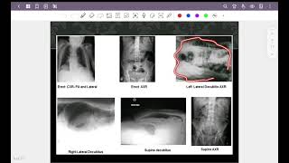 Abdominal radiograph part 1  How to approach to abdominal xray amp pneumoperitoneum [upl. by Yeaton251]