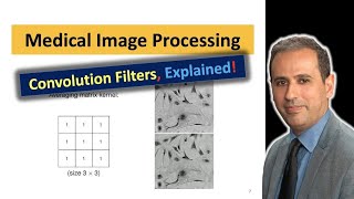 Medical Images Enhancement via Smoothing  Convolution Filters  Image Processing  Dr Loay AlZube [upl. by Ramedlab]