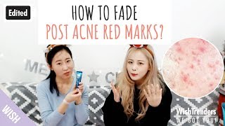 Edited How to Fade Post Acne Red Marks Post Acne Skin Care Tips  My Acne Story  WWGY [upl. by Nnaycart]