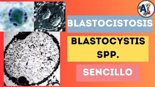 BLASTOCISTOSIS  BLASTOCYSTIS SPP POSIBLE CAUSA DEL INTESTINO IRRITABLE [upl. by Llerahs]