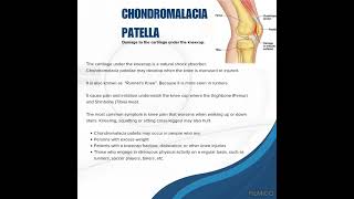 Chondromalacia Patella KNOWLEDGE AROUND  WELCOME TO KNOWLEDGE AROUND I knowlegdearound [upl. by Betti768]