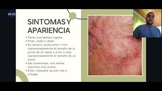 QUERATOSIS ACTÍNICA  Jorge Tamara  Rot 2524 DERMATOLOGÍA [upl. by Harac]