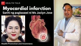 Myocardial infarction Sanhi ng pagkasawi ni Ms Jaclyn Jose [upl. by Schulze]