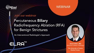 Percutaneous Biliary Radiofrequency Ablation RFA for Benign Strictures Webinar [upl. by Enyallij]