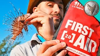 How to Cure a Lionfish Sting [upl. by Anivid]