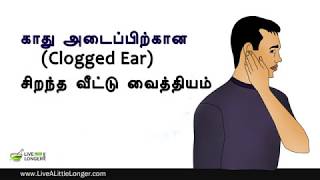 காது அடைப்பிற்கான சிறந்த வீட்டு வைத்தியம்  Home Remedies For Clogged Ears [upl. by Hege]