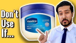 Vaseline on Face  Watch FIRST Before Using 🚨 [upl. by Oigolue492]