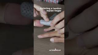 Mallet finger splint demo [upl. by Euqinom]