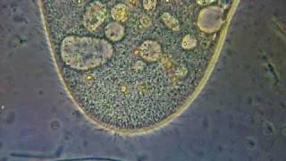 Paramecium  phase contrast microscope [upl. by Sil90]