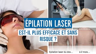 ÉPILATION LASER  TOUT CE QUE VOUS DEVEZ SAVOIR [upl. by Siraj]