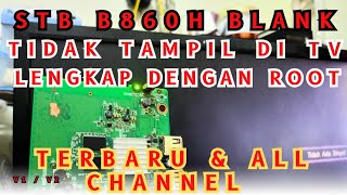 Solusi STB B860H blank tidak tampil di TV  Tutorial Solution STB Blank [upl. by Ahsiuq]