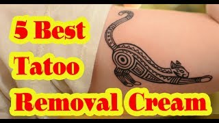 Best Tattoo Removal Cream to buy in 2020 [upl. by Cohen]