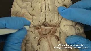 Circle of Willis A brief demonstration and identification neuroanatomy arteriesmedicalstudent [upl. by Moth]