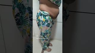 Doming or coning in Diastasis Recti patients and the repair  Arogya physiotips [upl. by Anitnatsnok]