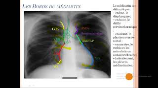 syndrome mediastinal 01 [upl. by Naitsyrk]