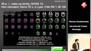 Interventionelle Therapie bei akuter neurologischer Symptomatik  Hannes Deutschmann [upl. by Keeton]