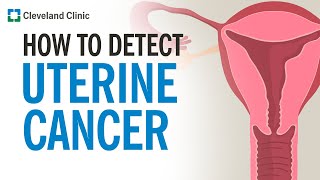 How Is Uterine Cancer Diagnosed [upl. by Andromache]