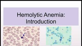 Hemolytic Anemias Introduction and Classification [upl. by Eldin]