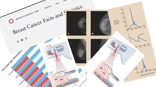 Mamografía para técnicos radiólogos  Introducción a la Imagenología  UNAH [upl. by Nnylear715]