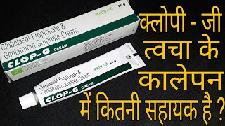 Clop  G Cream त्चचा के कालेपन को 100 मिटाता है [upl. by Dnumyar]