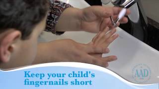 Eczema Tips to help your child feel better [upl. by Bryon162]