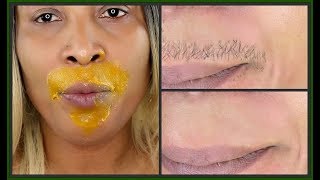 IN 5 MINUTES REMOVE UNWANTED FACIAL HAIR UPPER  LOWER LIPS FOR GOOD  Khichi Beauty [upl. by Nah]