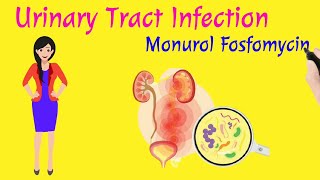 UTI  Monurol 3g Fosfomycin Trometamol  Urinary Tract Infection  UTI  Dr Anil Thakor [upl. by Roye]