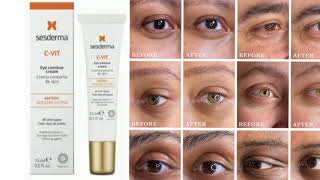 Sesderma CVIT Eye Contour Cream [upl. by Westlund]