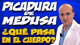 PICADURA DE MEDUSA  ¿Qué pasa dentro del cuerpo de las personas que la padecen [upl. by Southard]