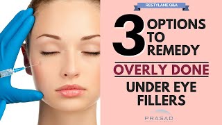 Options to Remove Excess Filler Placement and Treatments to Improve Under Eye Area [upl. by Neros]