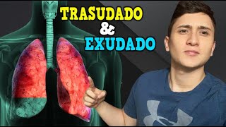 EXPLICANDO CÓMO SE GENERAN LOS EXUDADO Y TRASUDADO Y COMO DIFERENCIARLOS CRITERIOS DE LIGHT [upl. by Stauder658]