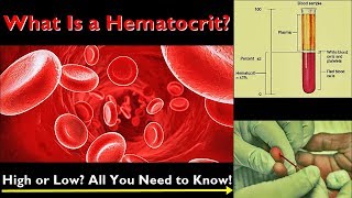 Hematocrit – Normal Range Low and High Levels Causes [upl. by Ahsoem947]