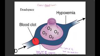 Unit 4 Respiratory [upl. by Buckden]