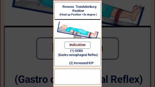 Reverse Trendelenburg Position [upl. by Nosiram]